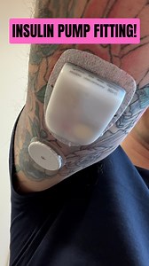 I’m taking the plunge today and getting fitted with a hybrid closed loop insulin pump system. 🥰🥰🥰🥷🌿🙌 After decades of managing my diabetes the old school way with multiple daily injections, I’m finally joining the 21st century! For those who don’t know what a hybrid closed loop system is, it’s essentially a wearable pump that talks to a continuous glucose monitoring system. The pump and sensor have a proper conversation throughout the day, with the CGM constantly feeding glucose readings t