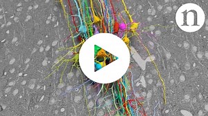 WATCH Neuroscience: Crammed with connections