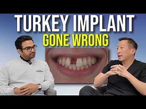 Front Tooth Dental Implants: What Many Dentists DON'T Tell You
