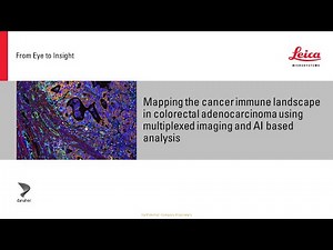 Mapping the landscape of colorectal adenocarcinoma with imaging and AI