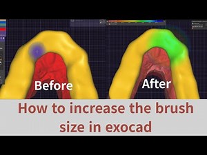 how to increase the brush size in exocad