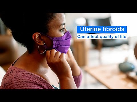 Mayo Clinic Minute - Know your uterine fibroid treatment options
