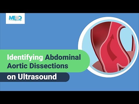 Identifying Abdominal Aortic Dissections on Ultrasound