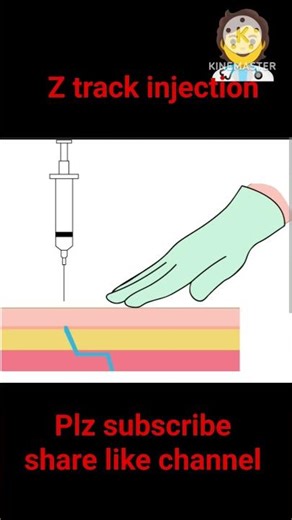 Z-track injection method #shortsfeed #youtubeshorts #shorts