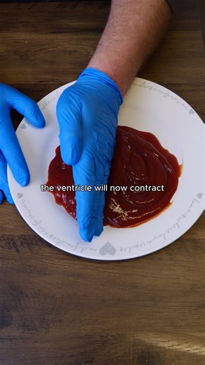 17K views · 65 reactions | Ejection fraction explained with ketchup 樂 | The Medical Lounge | Facebook