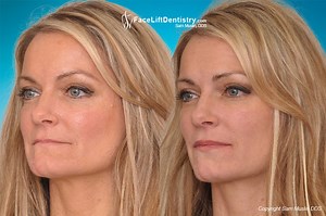 Face Lift Dentistry Reviews and Testimonials
