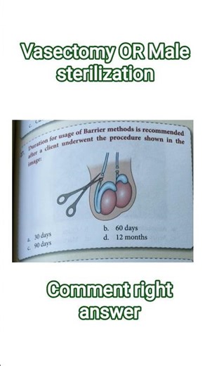 After Vasectomy how many days or month used other contraceptive method 90 days ( 3 months)