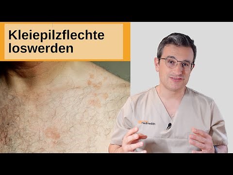How to get rid of tinea versicolor (pityriasis versicolor) Dr. Kasten, Mainz