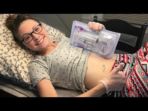 CHANGING MY FEEDING TUBE BUTTON AT HOME! (9.6.17)