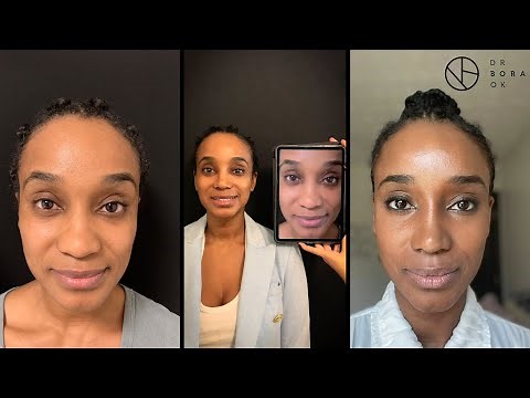 Natural Change Ethnic Rhinoplasty Surgery in Turkey By Dr. Bora Ok