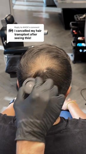 The #1 Fix for Hair Loss — Waterproof & Sweat-Proof 💦 Enjoy FAST delivery a 100% money-back guarantee! 🧡🚚 HairBear works instantly to conceal thinning hair, bald spots, and receding hairlines—giving you a fuller, natural look in just seconds. No waiting. No mess. No expensive treatments—just real results, right away. ✨ Why it works 🧴👇 ✔️ Ultra-fine powder that blends seamlessly with your natural hair. ✔️ Instant coverage for bald spots, thinning patches & uneven hairlines. ✔️ Waterproof, sw