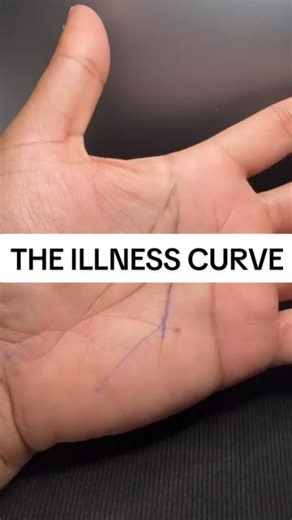 Understanding Palmistry and Its Link to Health Signals