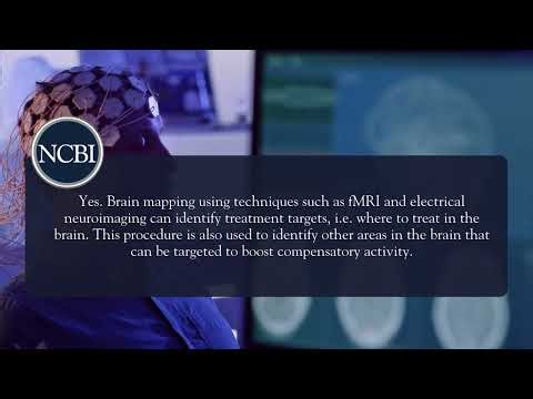 FAQ: Can brain mapping improve treatment outcomes?
