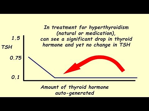 Hyperthyroidism & Graves Disease - Lab Test Interpretation