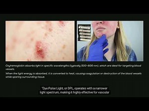 "IPL Explained: Broadband Light (BBL) vs. Dye Pulse Light (DPL) - Key Differences & Benefits"