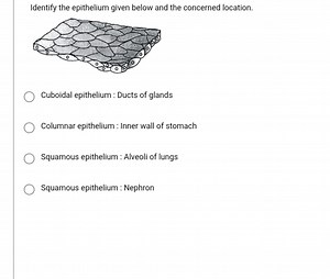 Identify the epithelium given below and the concerned location.... | Filo
