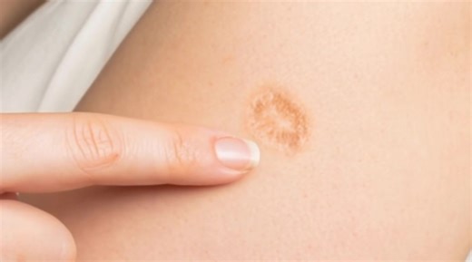 Here’s The Truth Behind This Scar On People’s Upper Left Arm. Check the comments below👇👇👇 | Vibes Corner