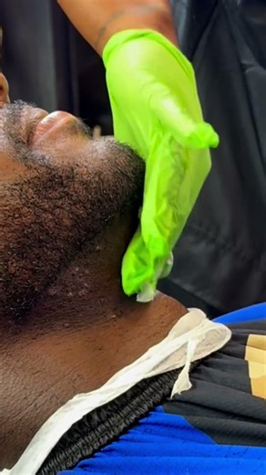 Barber Uses Bump Stopper for a Smooth, Bump-Free Finish