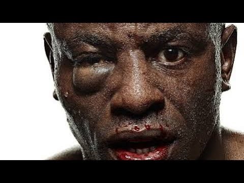 Nys Prison : Worst Beatdown Ive ever seen. Had him looking like elephant man #talesfromthepen