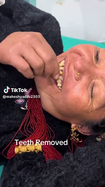 #Teethremoved#@@Madhu 🌸❤️ @Mr. गडुल @Limbuni❣️❣️😘 @Ganga👩‍⚕️ @Binuu @alinarai456 @J E N I S H A @Tamangni💗 #Tamorhospital #