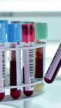 Transferrin: transports iron in the blood