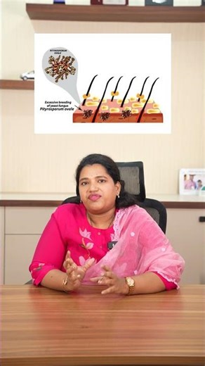 What is Dandruff? Causes, Facts & Solutions | Dr. Sushma Sukruthi | Anaha Clinic#shorts