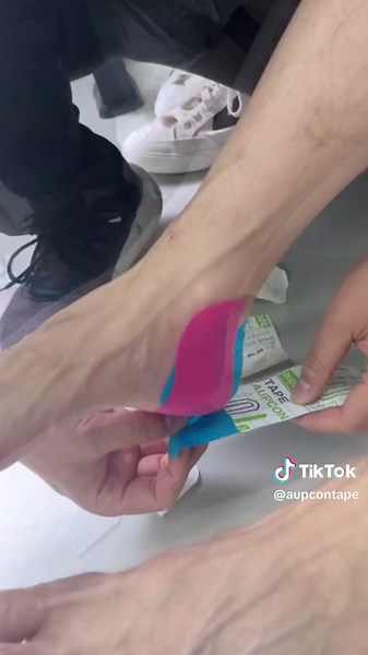 Heel pain after prolonged excessive exercise can be caused by various conditions,including tendonitis,bursitis,or plantar fasciitis.Using kinesiology tape can help prevent heel injuries without restricting movement.Providing as much support as possible can be very helpful in relieving heel pain#kinesiologytape #heelpain #plantarfasciitis #feetpain #anklepain #physicaltherapy