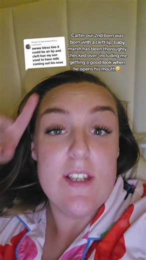 Cleft Lip Awareness: Carter's Journey and Baby Marshall's Checkups