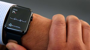 Apple Watch to get higher-end model