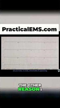 Flutter Waves vs. P Waves: Heart Block Diagnosis Explained! #shorts