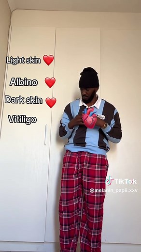 😗 please don’t come for me #foryoupage #vitiligo #lightskin #darkskin #albino