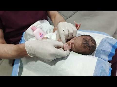 “Newborn Feeding Time Routine & Gentle Physiotherapy | Essential NICU Care Guide for Parents