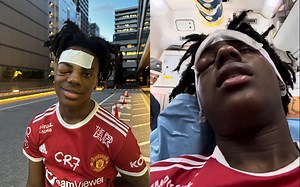 "Speed didn't die" - IShowSpeed out of hospital after severe sinus infection, fans react