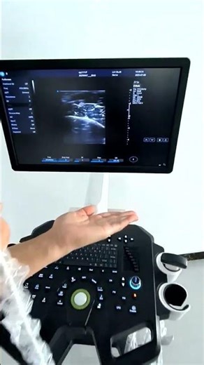 LifePlus UltraView LPM 807 Linear Probe Demo | Color Doppler Imaging
