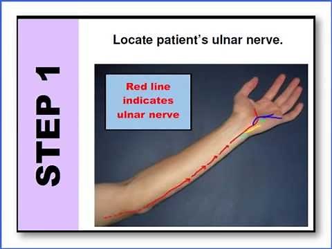 Train of Four Audio Bite