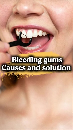 Causes of Bleeding Gums and Remedies for Healthy Gums