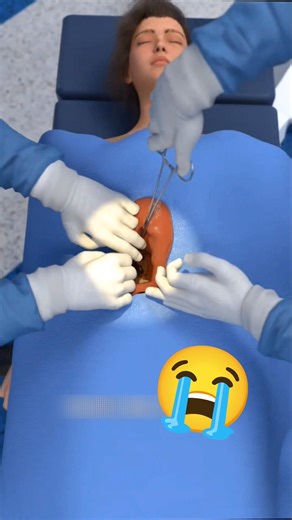 😭பாவம் அந்த பொண்ணு..😱 #doctor #facts #tamilshorts #factshorts #viralvideo #shorts #kidney #tamil