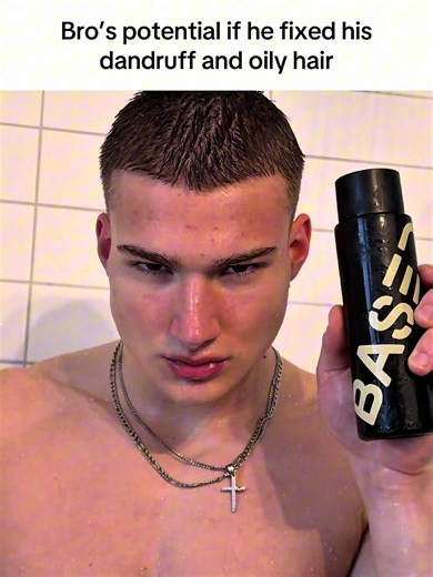 I use @BASED shampoo #model #chad #aura #viral | dandruff