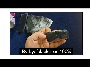 How to remove blackheads●●how to use blackhead nose strips #blackheadremoval