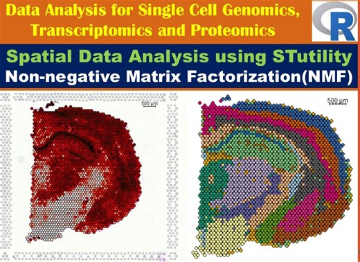 Spatial Data Analysis using STutility: Non-negative Matrix Factorization (NMF)