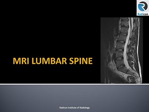 Lumbar Spine MRI Part 1: Indications, Protocols, Layout