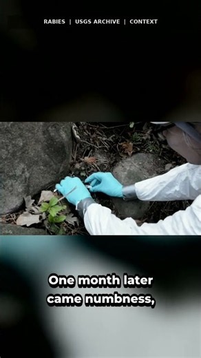 The Girl Who Survived Rabies