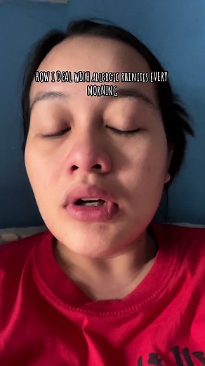 Effective Ways to Manage Allergic Rhinitis Symptoms