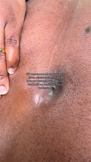 Helly Hutton healing isn’t just about the wounds on my body… it’s about the pieces of my spirit I’m stitching back together one day at a time. Healing taught me that you don’t have to be whole to shine—sometimes the light comes from the cracks. I’ve carried pain in places nobody sees… under my arms, around my belly button, across my back, and deep in my heart. But I’ve also carried courage. And every time I choose to keep going, keep loving myself, keep believing in my tomorrow, I feel that cour