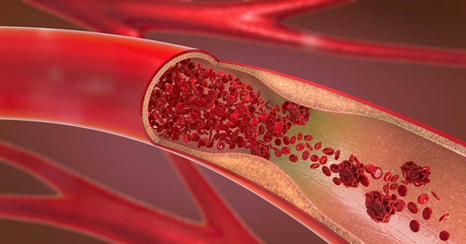 Hypogammaglobulinémie : symptômes, infections, risques et traitements