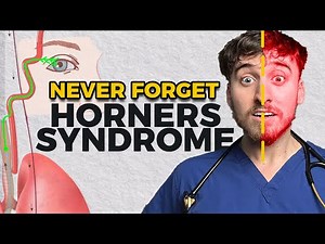 Horner’s Syndrome: Everything You Need to Know (and how to remember it)