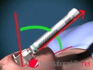 How to intubate a patient.