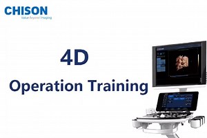 1.3K views · 33 reactions | What is #4D #ultrasound? What's the difference between 4D and 2D? How to get a good 4D image using CHISON CBit Series? Well, watch the video and follow the most comprehensive #CHISON CBit 4D operation guide NOW! | CHISON Ultrasound Manufacturer | Facebook