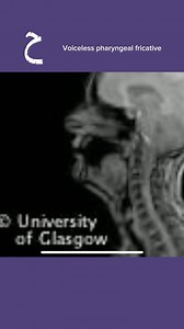 139K views · 315 reactions | A short one on the difference between ح and خ in Arabic, the voiceless pharyngeal fricative and the voiceless velar or uvular fricative. The video looks like a cheap powerpoint. Oh well… maybe i’ll expand to it at some point. #voicelesspharyngealaffricate #voicelessvelarfricative #voicelessuvularfricative #arabicphonology #اللغة_العربية #مخارج_الحروف | Cedrusk | Facebook