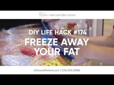 Coolsculpting Commercial 2018